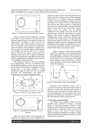 Denoising of ECG -- A discrete time approach using DWT | PDF