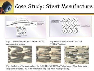 Case Study: Stent Manufacture
Fig: The Guidant MULTI-LINK TETRATM
coronary stent system.
Fig: Detail of the 3-3-3 MULTI-LINK
TETRATM pattern.
Fig: Evolution of the stent surface. (a) MULTI-LINK TETRATM after lasing. Note that a metal
slug is still attached. (b) After removal of slag. (c) After electropolishing.
 