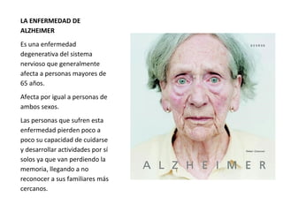 LA ENFERMEDAD DE
ALZHEIMER
Es una enfermedad
degenerativa del sistema
nervioso que generalmente
afecta a personas mayores de
65 años.
Afecta por igual a personas de
ambos sexos.
Las personas que sufren esta
enfermedad pierden poco a
poco su capacidad de cuidarse
y desarrollar actividades por sí
solos ya que van perdiendo la
memoria, llegando a no
reconocer a sus familiares más
cercanos.
 