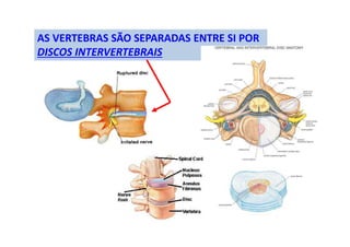 AS VERTEBRAS SÃO SEPARADAS ENTRE SI POR
DISCOS INTERVERTEBRAIS
 