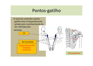 Pontos-gatilho
O músculo contendo o ponto-
gatilho ativo é frequentemente
achado pelo reconhecimento da
dor referiada pelo
paciente.
TrP
Dor percebida
Frequentemente frio
Parestesia
Dormência
Infraespinhoso
 