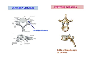 VERTEBRA CERVICAL
Forame transverso
VERTEBRA TORÁCICA
Estão articuladas com
as costelas
 