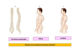 Curvaturas esperadas Cifose Lordose
Desvios nas curvaturas da coluna vertebral
 