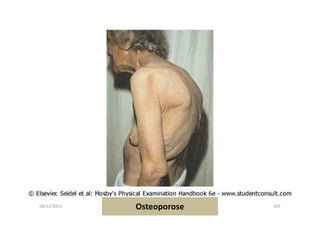 08/12/2015 Dr. José Heitor M. Fernandes 203Osteoporose
 