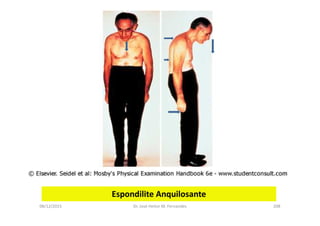08/12/2015 Dr. José Heitor M. Fernandes 208
Espondilite Anquilosante
 