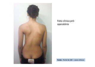 Foto clínica pré-
operatório
Fonte: Portal da SBC – casos clínicos
 