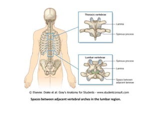 Spaces between adjacent vertebral arches in the lumbar region.
 