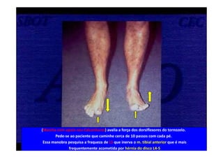 08/12/2015 Dr. José Heitor M. Fernandes 424
(Marcha com apoio nos Calcanhares) avalia a força dos dorsiflexores do tornozelo.
Pede-se ao paciente que caminhe cerca de 10 passos com cada pé.
Essa manobra pesquisa a fraqueza de L5 que inerva o m. tibial anterior que é mais
frequentemente acometida por hérnia do disco L4-5
 