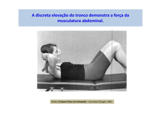 A discreta elevação do tronco demonstra a força da
musculatura abdominal.
Reider, O Exame Físico em Ortopedia – Guanabara Koogan -2001
 
