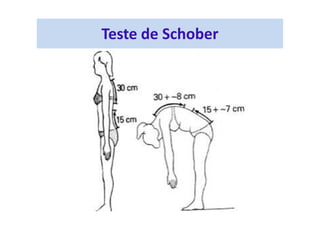Teste de Schober
 