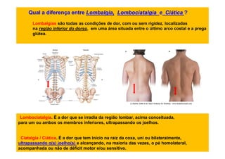 Qual a diferença entre Lombalgia, Lombociatalgia e Ciática ?
Lombalgias são todas as condições de dor, com ou sem rigidez, localizadas
na região inferior do dorso, em uma área situada entre o último arco costal e a prega
glútea.
Lombociatalgia. É a dor que se irradia da região lombar, acima conceituada,
para um ou ambos os membros inferiores, ultrapassando os joelhos.
Ciatalgia / Ciática. É a dor que tem início na raiz da coxa, uni ou bilateralmente,
ultrapassando o(s) joelho(s) e alcançando, na maioria das vezes, o pé homolateral,
acompanhada ou não de déficit motor e/ou sensitivo.
 