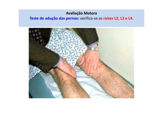 Avaliação Motora
Teste de adução das pernas: verifica-se as raízes L2, L3 e L4.
 