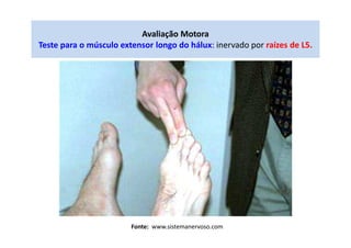 Avaliação Motora
Teste para o músculo extensor longo do hálux: inervado por raízes de L5.
Fonte: www.sistemanervoso.com
 