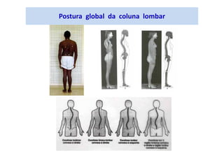 Postura global da coluna lombar
 