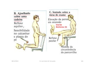 figura
08/12/2015 Dr. José Heitor M. Fernandes 444
Sinal de
Betcherew (3);
 