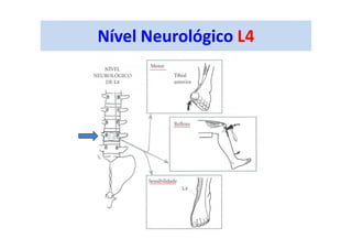 Nível Neurológico L4
 