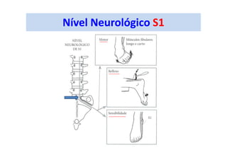 Nível Neurológico S1
 
