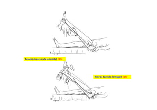 Dr. José Heitor M. Fernandes
Elevação da perna reta (estendida) (3,5)
Teste da Extensão de Bragard (3,5)
 