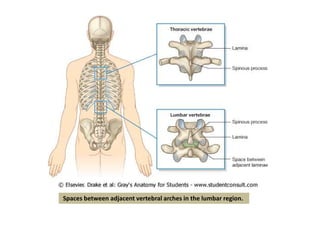Spaces between adjacent vertebral arches in the lumbar region.
 