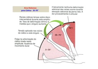 08/12/2015 Dr. José Heitor M. Fernandes 458
Arco Doloroso
para Ciática 35-70°
 