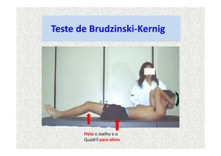 Teste de Brudzinski-Kernig
Flete o Joelho e o
Quadril para alívio
 