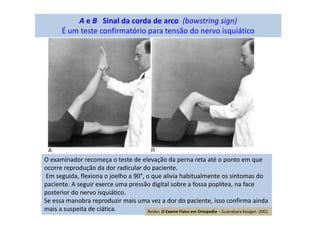 A e B Sinal da corda de arco (bowstring sign)
É um teste confirmatório para tensão do nervo isquiático
O examinador recomeça o teste de elevação da perna reta até o ponto em que
ocorre reprodução da dor radicular do paciente.
Em seguida, flexiona o joelho a 90°, o que alivia habitualmente os sintomas do
paciente. A seguir exerce uma pressão digital sobre a fossa poplítea, na face
posterior do nervo isquiático.
Se essa manobra reproduzir mais uma vez a dor do paciente, isso confirma ainda
mais a suspeita de ciática. Reider, O Exame Físico em Ortopedia – Guanabara Koogan -2001
 