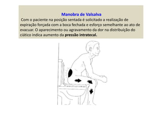 Manobra de Valsalva
Com o paciente na posição sentada é solicitado a realização de
expiração forçada com a boca fechada e esforço semelhante ao ato de
evacuar. O aparecimento ou agravamento da dor na distribuíção do
ciático indica aumento da pressão intratecal.
 