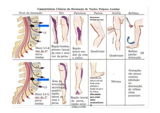 O hálux e o 2 PDD
Movimento
limitado ou fraco
L4
Extensão do
hálux e do pé.
Pode estar
afetada a
flexão do pé e
do hálux;
dificuldade
para andar
sobre
oscalcanhares
L5
 