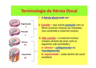 08/12/2015 Dr. José Heitor M. Fernandes 480
Terminologia da Hérnia Discal
• A hérnia discal pode ser:
1- Contida – aqui existe protusão com as
fibras anulares intactas ou rompidas,
mas contendo o material nuclear;
2- Não contida – o material nuclear
rompeu através do anel, com as
seguintes sub-variedades:
a- extrusa – subligamentar ou
transligamentar
b- sequestrada – caída dentro do canal
vertebral
1
1
2a
2b
Protusão
Extrusa
Sequestrada
Degeneração
 