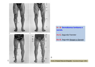 Reider, O Exame Físico em Ortopedia – Guanabara Koogan -2001
A – D Dermátomos lombares e
sacrais.
A e C, Segundo Foerster
B e D, Segundo Keegan e Garrett
C
D
 