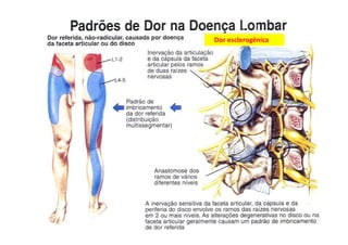 figura
Dor esclerogênica
 