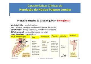 08/12/2015 Dr. José Heitor M. Fernandes 498
Características Clínicas da
Herniação do Núcleo Pulposo Lombar
Protusão massiva da Cauda Equina = Emergência!
Modo de início: agudo, insidioso
Dor: perineal, na região posterior das coxas e das pernas
Déficit motor: Bexiga (retenção), incontinência intestinal
Déficit sensorial: perianal (anestesia em sela)
Perda de reflexo: cremastérico
Nível da herniação Dor Parestesia Paresia Atrofia Reflexos
 