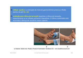 08/12/2015 Dr. José Heitor M. Fernandes 506
E- reflexo aquileu ( a contração do músculo gastrocnêmico provoca a flexão
plantar do pé) S1 e S2
F- avaliação para clônus do tornozelo (examine o clônus do tonozelo,
especialmente se os reflexos estiverem hiperativos. O Clônus sustentado está
associado à doença do neurônio motor superior.
 