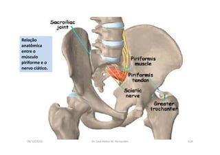 08/12/2015 Dr. José Heitor M. Fernandes 518
Relação
anatômica
entre o
músculo
piriforme e o
nervo ciático.
 