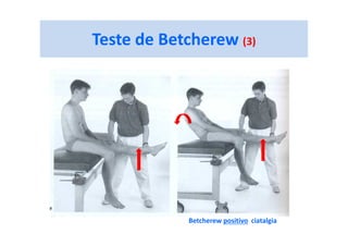 Teste de Betcherew (3)
Betcherew positivo ciatalgia
 