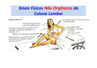 Sinais Físicos Não Orgânicos da
Coluna Lombar
 
