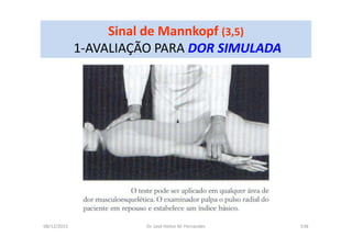 08/12/2015 Dr. José Heitor M. Fernandes 538
Sinal de Mannkopf (3,5)
1-AVALIAÇÃO PARA DOR SIMULADA
 