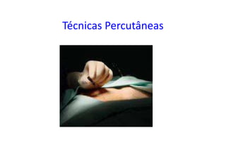 Técnicas Percutâneas
 