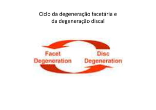 Ciclo da degeneração facetária e
da degeneração discal
 
