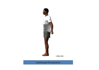 figura
Imobilização Pós-operatória
 