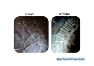 Fonte: Portal da SBC – casos clínicos
 