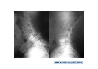 Fonte: Portal da SBC – casos clínicos
 