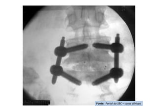 Fonte: Portal da SBC – casos clínicos
 