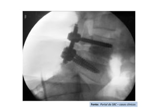 Fonte: Portal da SBC – casos clínicos
 