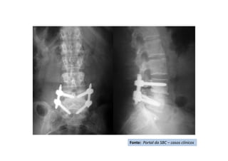 Fonte: Portal da SBC – casos clínicos
 