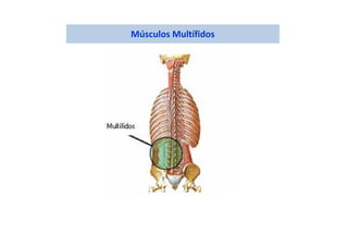 Músculos Multífidos
 