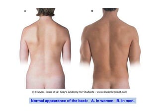 Normal appearance of the back: A. In women B. In men.
 