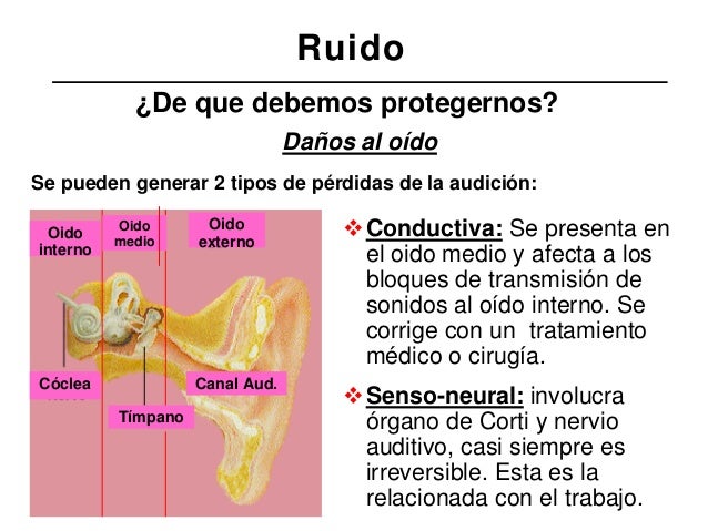 ruido y vibraciones