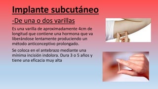 Implante subcutáneo
-De una o dos varillas
Es una varilla de aproximadamente 4cm de
longitud que contiene una hormona que va
liberándose lentamente produciendo un
método anticonceptivo prolongado.
Se coloca en el antebrazo mediante una
mínima incisión indolora. Dura 3 o 5 años y
tiene una eficacia muy alta
 