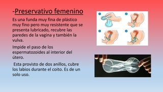 -Preservativo femenino
Es una funda muy fina de plástico
muy fino pero muy resistente que se
presenta lubricado, recubre las
paredes de la vagina y también la
vulva.
Impide el paso de los
espermatozoides al interior del
útero.
Esta provisto de dos anillos, cubre
los labios durante el coito. Es de un
solo uso.
 